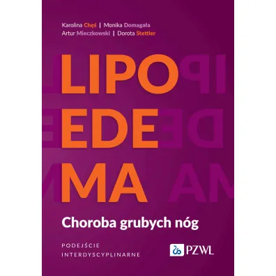 Lipoedema. Choroba grubych n�g. Podej�cie interdyscyplinarne - Artur  Mieczkowski, Dorota  Stettler, Karolina  Ch�, Monika  Domaga�a
