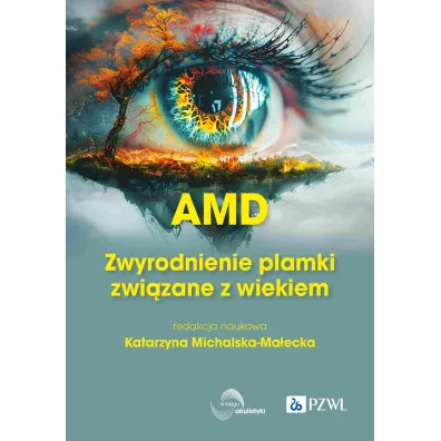 AMD Zwyrodnienie plamki ��tej zwi�zane z wiekiem - Katarzyna Michalska-Ma�ecka