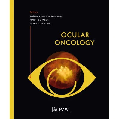 Ocular Oncology - Bo�ena Romanowska-Dixon