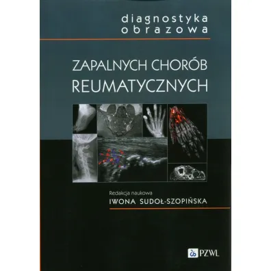 Diagnostyka obrazowa zapalnych chor�b reumatycznych