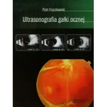 Ultrasonografia ga�ki ocznej