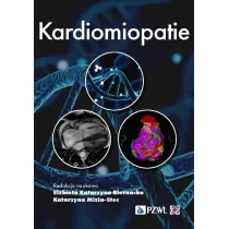 Kardiomiopatie