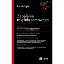 Zapalenie mi�nia sercowego, a niewydolno�� serca. W gabinecie lekarza specjalisty
