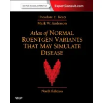 Atlas of Normal Roentgen Variants That May Simulate Disease