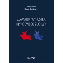 Z�amania wyrostka k�ykciowego �uchwy