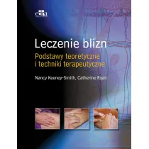 Leczenie blizn pourazowych