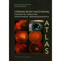 Czerniak b�ony naczyniowej. Diagnostyka r�nicowa