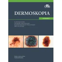 Dermoskopia
