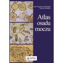 Atlas osadu moczu