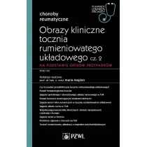 Obrazy kliniczne tocznia rumieniowatego uk�adowego. Cz�� 2. Na podstawie opis�w przypadk�w. Choroby reumatyczne. W gabinecie lekarza specjalisty