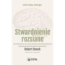 Stwardnienie rozsiane