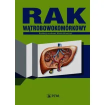 Rak w�trobowokom�rkowy