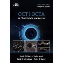 Oct i octa w chorobach siatk�wki