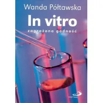 In vitro zagro�ona godno��
