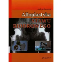 Alloplastyka stawu biodrowego