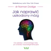 Jak naprawi uszkodzony mzg