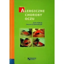 Alergiczne choroby oczu
