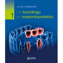 Od bondingu do implantoprotetyki. Tom 1