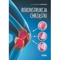 Rekonstrukcja chrz�stki. Ratujemy kolano, nie wymieniamy