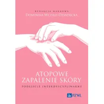 Atopowe zapalenie sk�ry. Podej�cie interdyscyplinarne