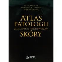 Atlas patologii z�o�liwych nowotwor�w sk�ry