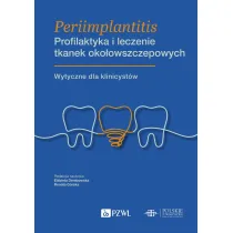 Periimplantitis. Profilaktyka i leczenie tkanek oko�owszczepowych