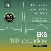EKG 160 przypadk�w