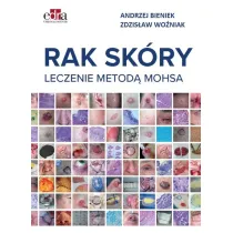 Rak sk�ry. Leczenie metod� Mohsa