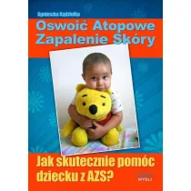 Oswoi� atopowe zapalenie sk�ry