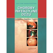 Choroby infekcyjne oczu. Kompendium diagnostyki i leczenia