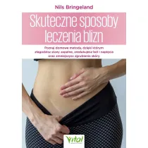 Skuteczne sposoby leczenia blizn