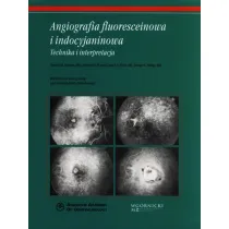 Angiografia fluoresceinowa i indocyjaninowa. Technika i interpretacja
