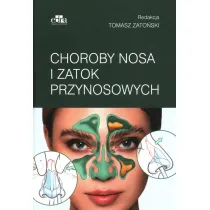 Choroby nosa i zatok przynosowych