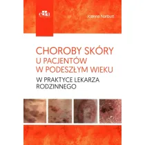 Choroby sk�ry u pacjent�w w podesz�ym wieku w praktyce lekarza rodzinnego