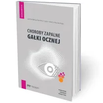 Choroby zapalne ga�ki ocznej - poradnik lekarza pr