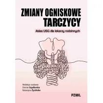 Zmiany ogniskowe tarczycy. Atlas USG dla lekarzy rodzinnych