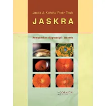 Jaskra. Kompendium diagnostyki i terapii