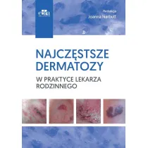 Najcz�stsze dermatozy w praktyce lekarza rodzinn.