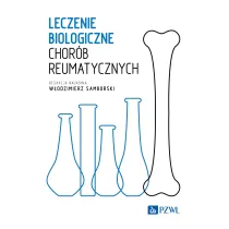 Leczenie biologiczne chor�b reumatycznych