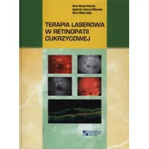 Terapia laserowa w retinopatii cukrzycowej