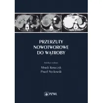 Przerzuty nowotworowe do w�troby