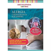 Alergia i nietolerancja pokarmowa. Encyklopedia zdrowia