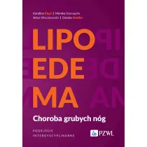 Lipoedema. Choroba grubych n�g. Podej�cie interdyscyplinarne