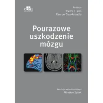 Pourazowe uszkodzenie m�zgu