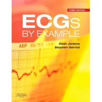 Ecgs By Example