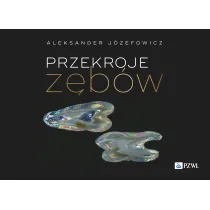 Przekroje z�b�w